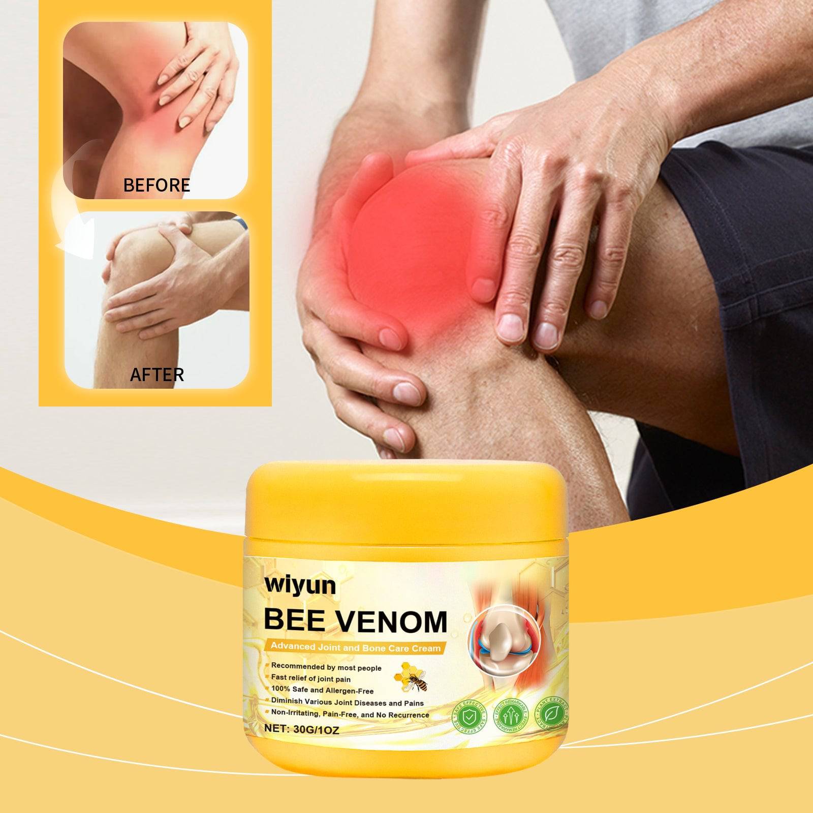 eprolo Wiyun Body Joint Repair Cream for wrist and knee massage, nourishing and soothing skin daily treatment.